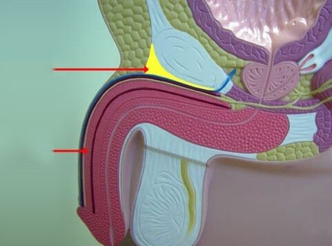 Táticas terapêuticas com um pequeno pau