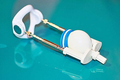 Extensor - um dispositivo para um aumento efetivo em um membro